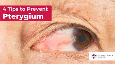 Prevent pterygium article header – First Aid Article in Wurtulla